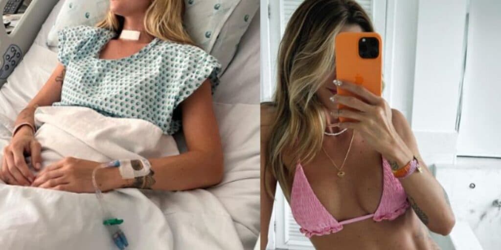Estrela do BBB descobriu câncer, lutou contra doença e hoje vive com sequelas de paralisia: 'Dias difíceis'