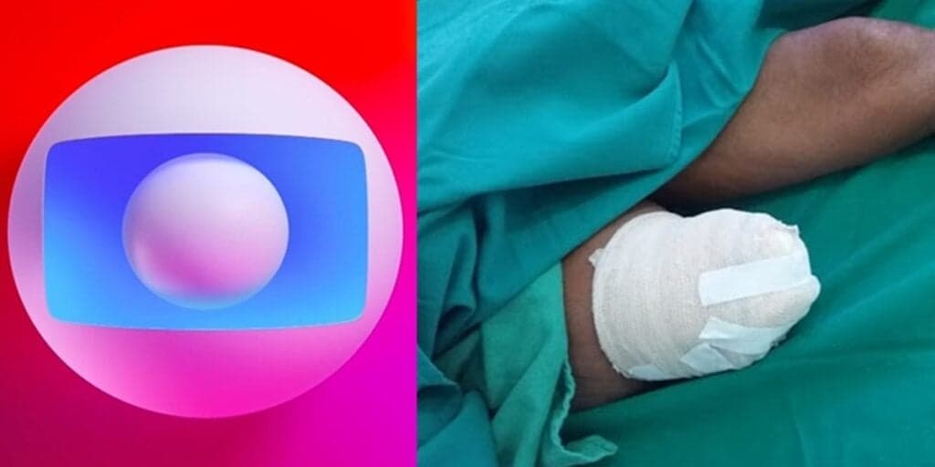 Dias após amputar as duas pernas, astro da Globo morreu de desgosto e sem poder andar