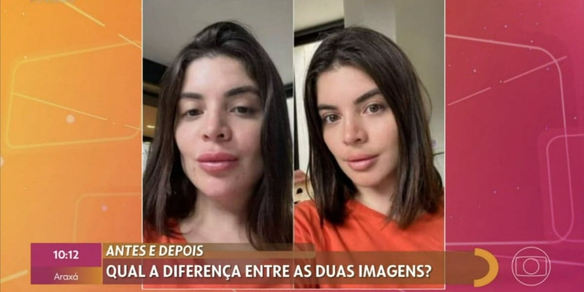 Procedimentos estéticos de GKay viraram notícia no "Encontro" (Foto: Reprodução/TV Globo)