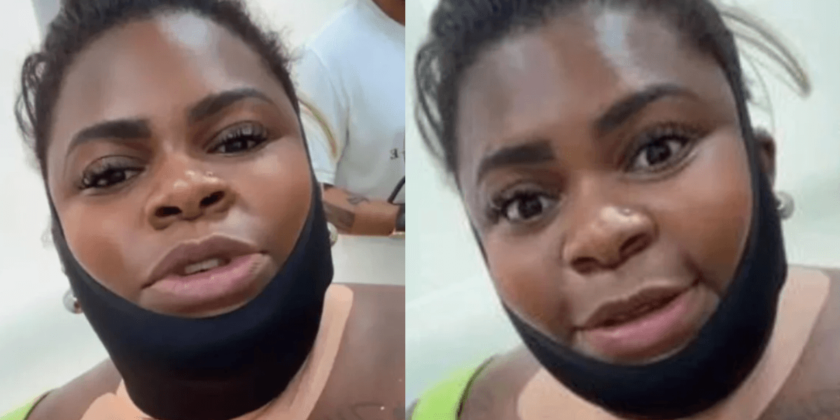 Jojo Todynho surgiu com o rosto enfaixado, mas tranquilizou os fãs ao explicar o motivo (Foto: Instagram) Jojo Todynho surgiu com o rosto enfaixado, mas tranquilizou os fãs ao explicar o motivo (Foto: Instagram)