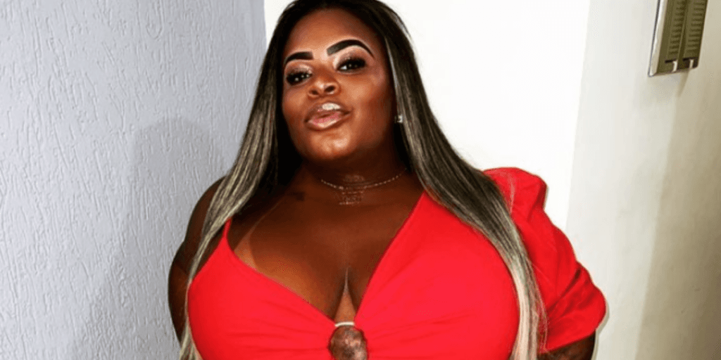 Jojo Todynho preocupa fãs e mostra resultado de procedimento: "Mostrar o antes e depois"