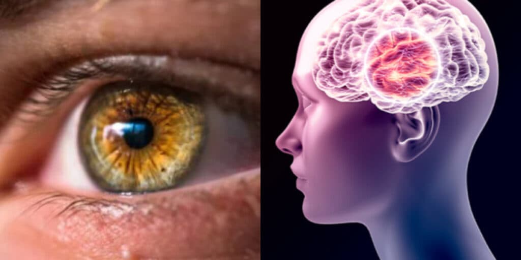 Atenção: Primeiros sinais de Alzheimer surgem nos olhos, dizem cientistas e se você tem é bom tomar cuidado