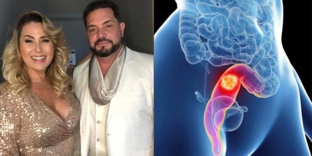 Alerta: Este foi o sintoma que o marido de Andréa Sorvetão teve antes de descobrir câncer no reto