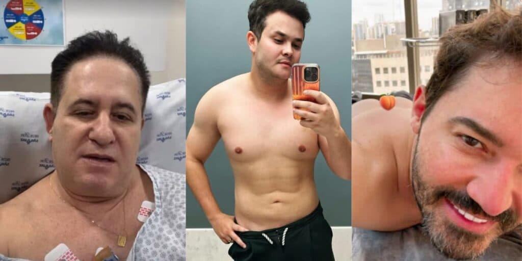 Procedimento no rosto, aumento de parte íntima e lipo: Marrone e sertanejos passam por mudanças em cirurgia