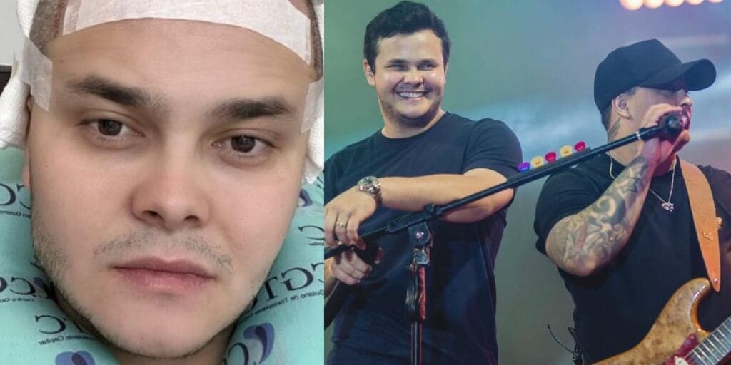 Após ficar irreconhecível com cirurgia no corpo, Matheus, dupla de Kauan, passa por procedimento na cabeça