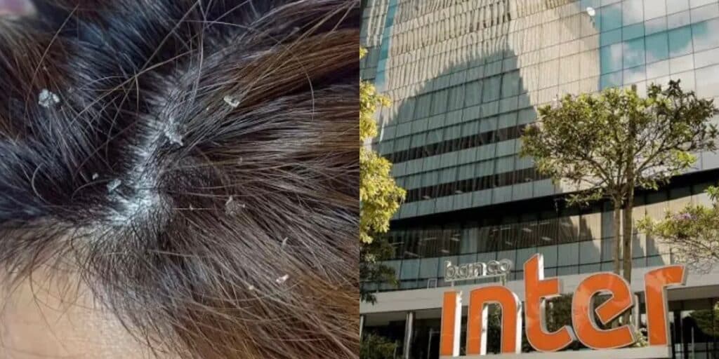 Cabelo sujo, mau hálito e chulé: Banco Inter faz carta aberta aos funcionários e causa reação absurda