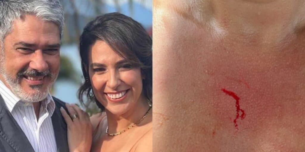Natasha Dantas, esposa de Bonner, sofre violência na rua, surge sangrando e faz desabafo: "Fui vítima"