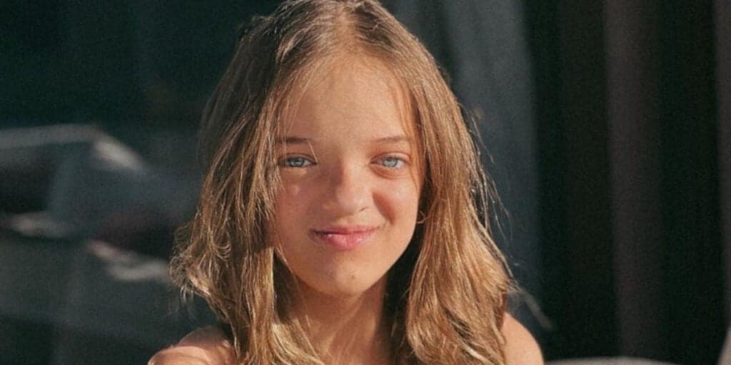 A mudança encantadora no rosto de Rafinha Justus que fez fãs vibrarem: "Reparem a diferença"