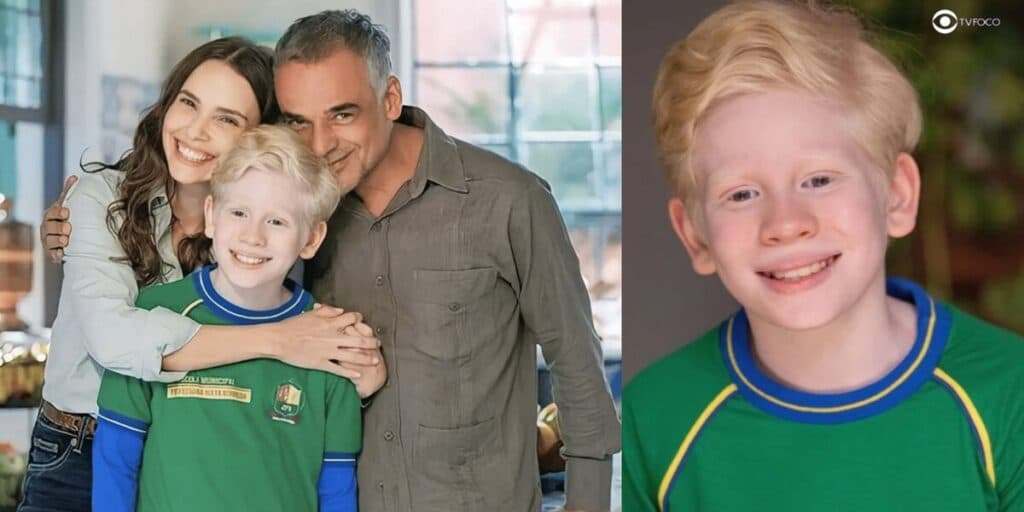 Terra e Paixão - Menino albino, filho de Lucinda na trama traz à tona o preconceito da síndrome: "Hostilizado"