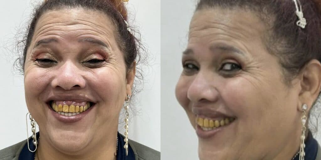 Gorete do Pânico volta à TV após 10 anos, passa por transformação e surge irreconhecível no SBT