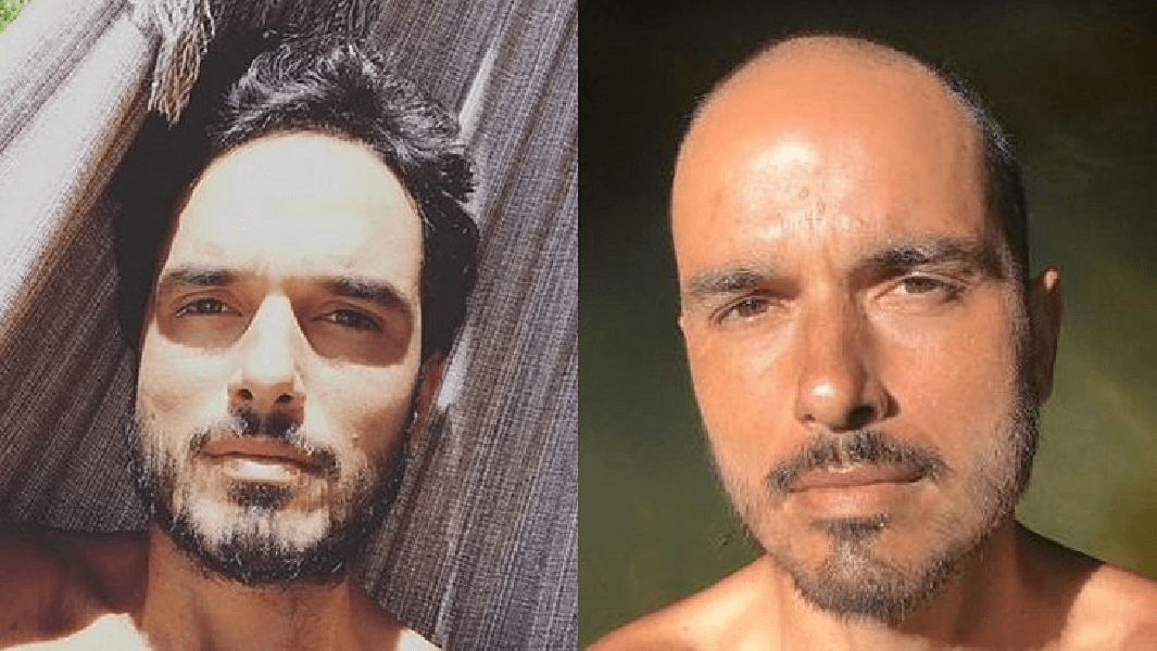 Antes e depois do ator (Foto: Reprodução/ Internet) Antes e depois do ator (Foto: Reprodução/ Internet)