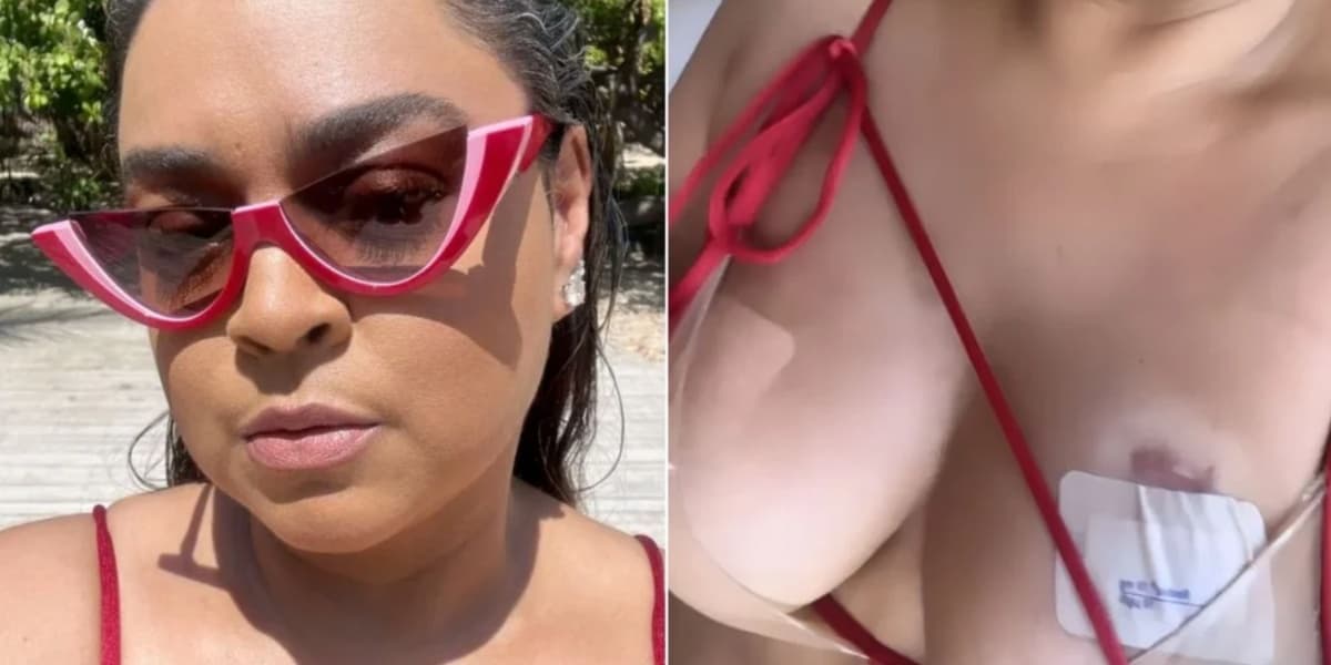 Preta Gil exibiu curativos para aliviar as dores (Foto: Reprodução/ Instagram)