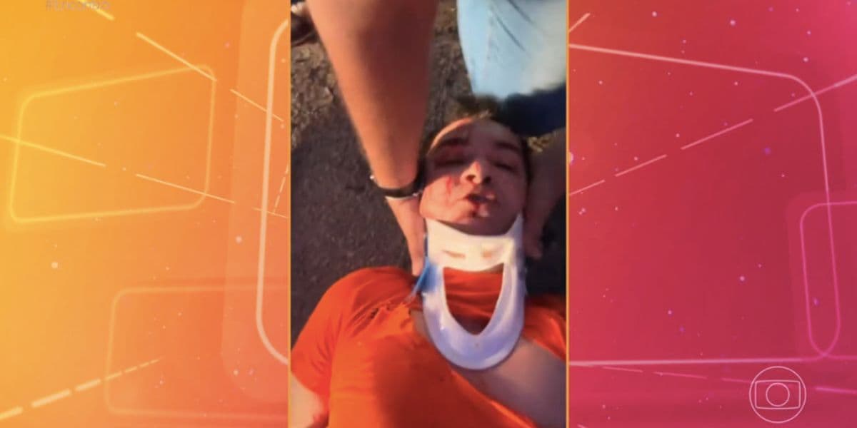 Regis Danese após acidente de carro (Foto: Reprodução / Encontro da Globo)