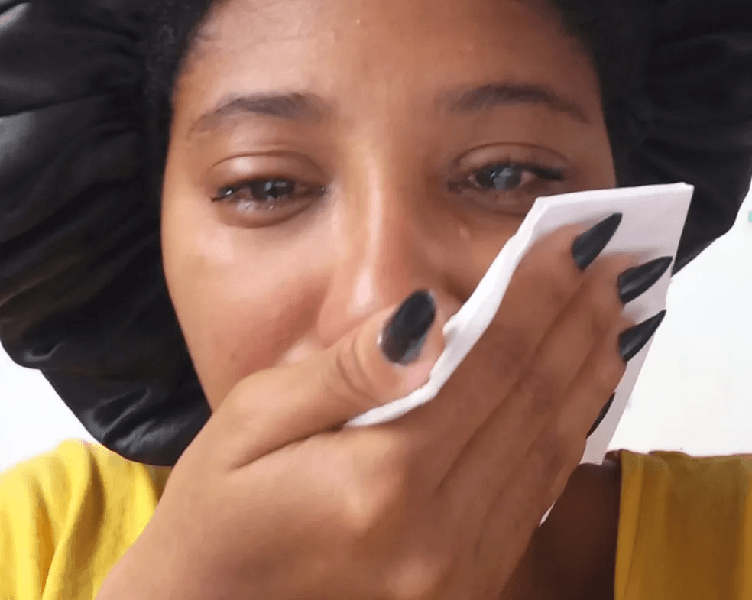 Mulher lacrimejando após uso de pomada (Foto: Reprodução/ Internet) Mulher lacrimejando após uso de pomada (Foto: Reprodução/ Internet)