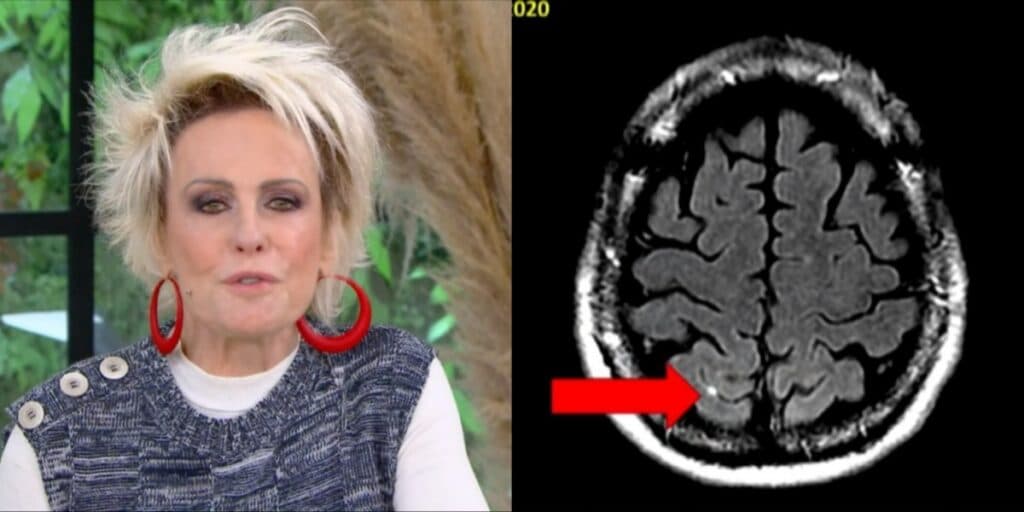 Médico fala sobre tumores de Ana Maria no Mais Você e loira assume ao vivo: "Depoimento que nunca dei"