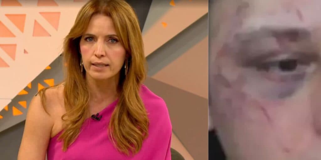 42 socos e rosto desfigurado: Poliana Abritta para o Fantástico e engasga ao dar notícia gravíssima de famoso