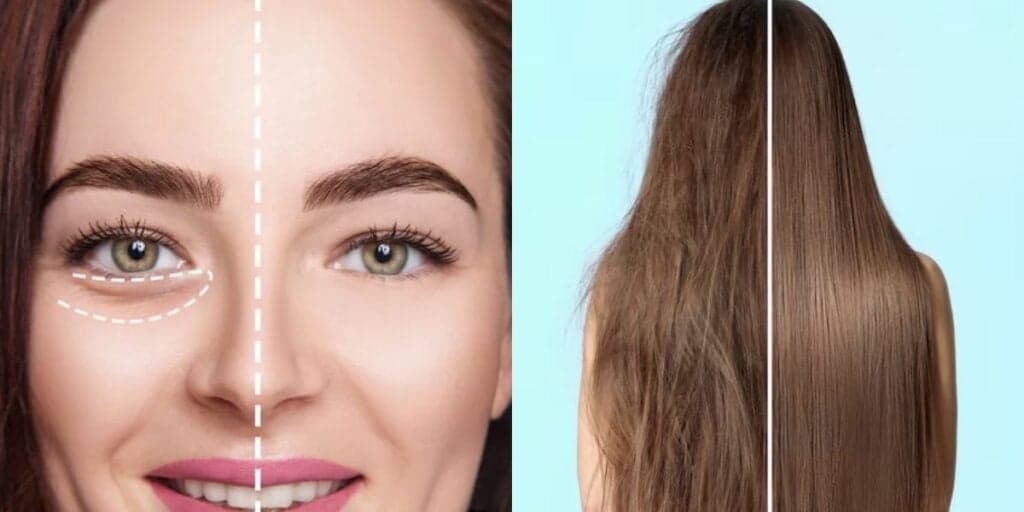 Ingrediente para fim das olheiras e receitinha para ressuscitar cabelo: 2 rituais salvadores antes de dormir