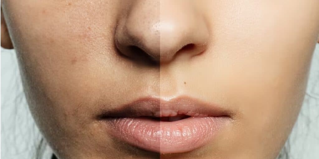 Melhor que qualquer colágeno: Receita caseira com só 1 ingrediente dá adeus ao botox e rejuvenesce décadas