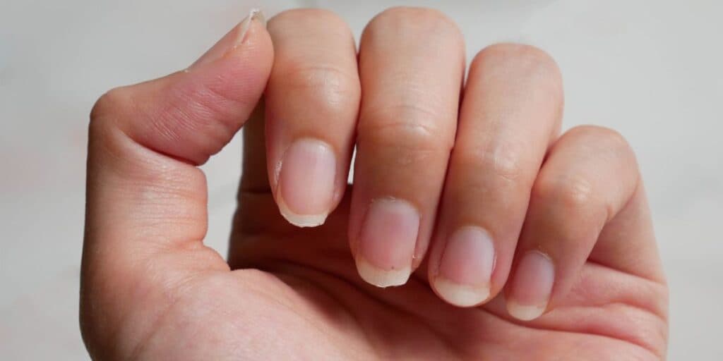 Não faça mais isso: 7 erros fatais que estão destruindo suas unhas e você precisa parar AGORA