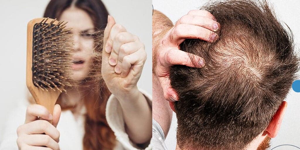 Adeus queda de cabelo: Receita caseira com 3 ingredientes que ressuscita os fios e faz parar de cair