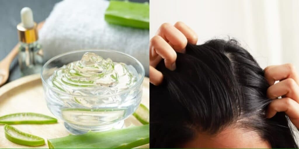 Salva o cabelo de homens e mulheres com mais de 40: 10 receitas baratas que acabam com a calvície de imediato