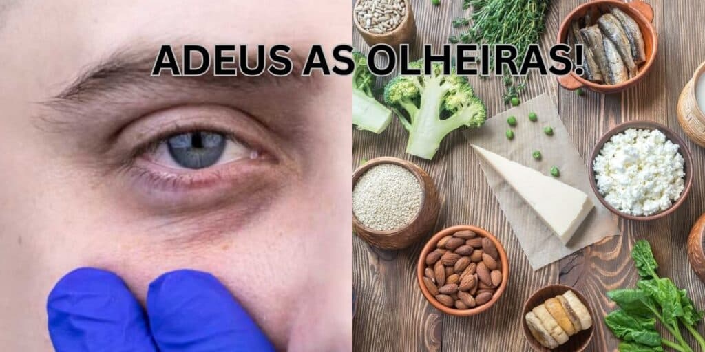 Para se livrar para sempre das terríveis olheiras: 7 receitinhas incríveis, simples, caseiras e infalíveis