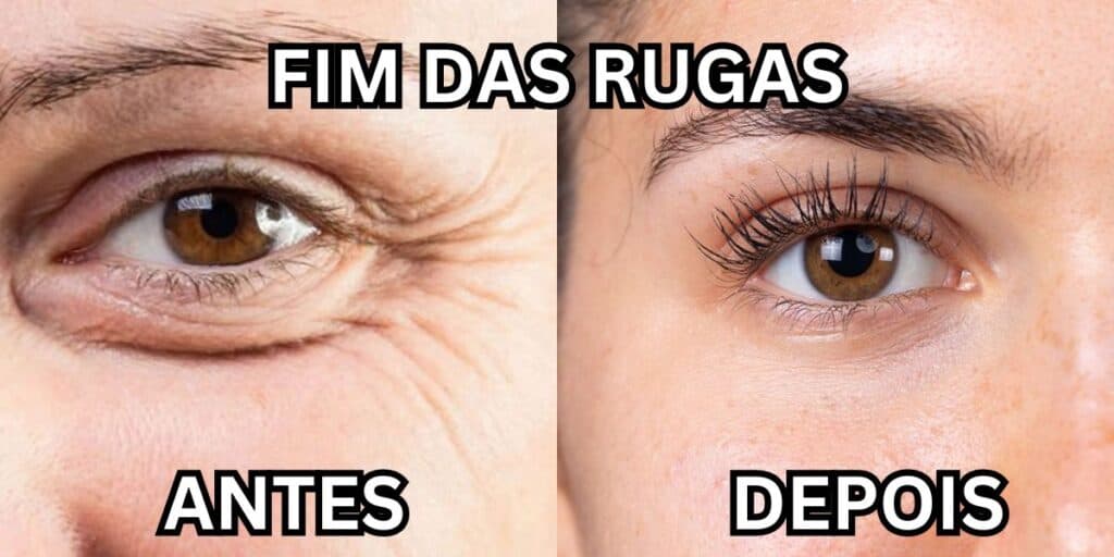Fim do envelhecimento e adeus às rugas: Receitinha caseira do MELHOR colágeno do mundo só com 2 ingredientes