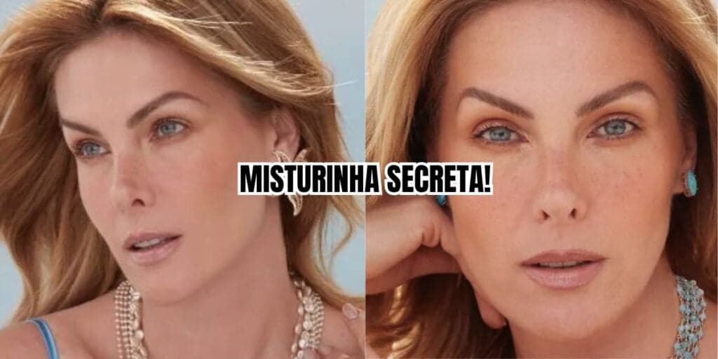 Harmonização facial caseira: A misturinha secreta e baratinha que Ana Hickmann usa e te livrará de botox