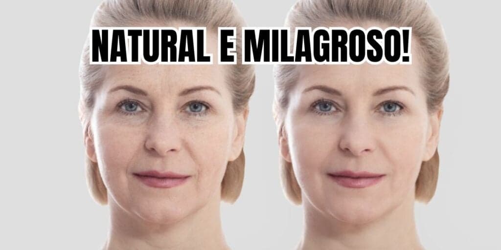 Colágeno natural deixa o botox no chinelo e acaba com as rugas (Reprodução/Montagem TV Foco)