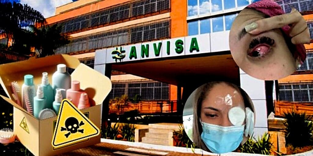 Queimaduras e inchaço: Anvisa baixa o facão às pressas e proíbe mais de 1000 produtos populares das mulheres