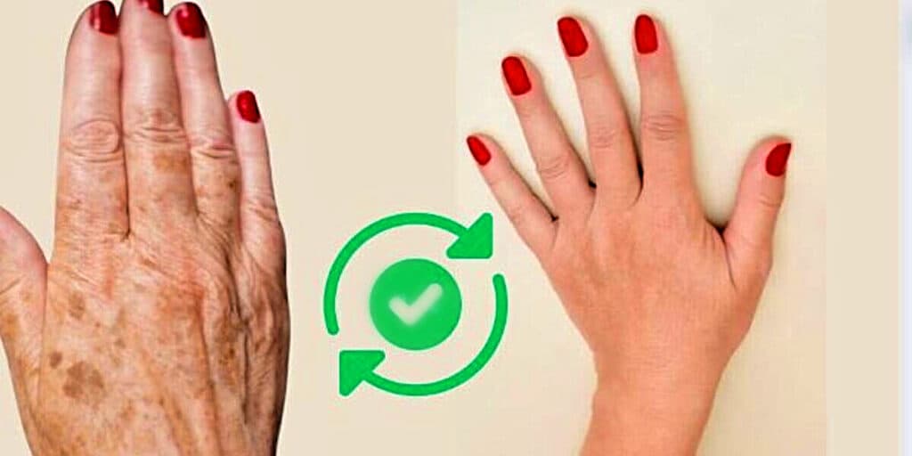 Mãos 30 anos mais jovem: Receitinha caseira com apenas 3 ingredientes dá adeus às manchas em minutos