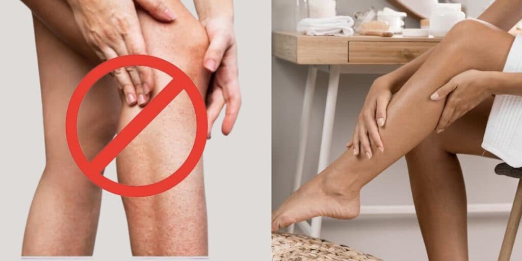 Adeus bolinhas vermelhas e irritação: 7 dicas INFALÍVEIS para garantir uma pele de bebê logo após se depilar