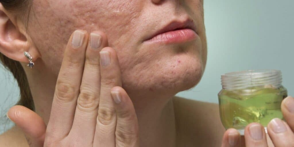 Pele de porcelana e adeus ao botox: 8 benefícios da babosa que farão você rejuvenescer