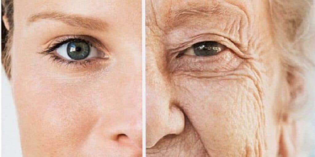 Fim das rugas e poros dilatados: Botox caseiro com 2 ingredientes traz pele lisinha e de diamante