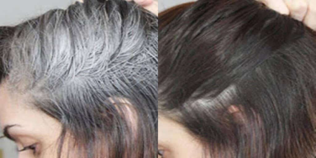 Adeus grisalho: Receitinha de chá milagroso com 2 ingredientes para acabar com o cabelo branco naturalmente