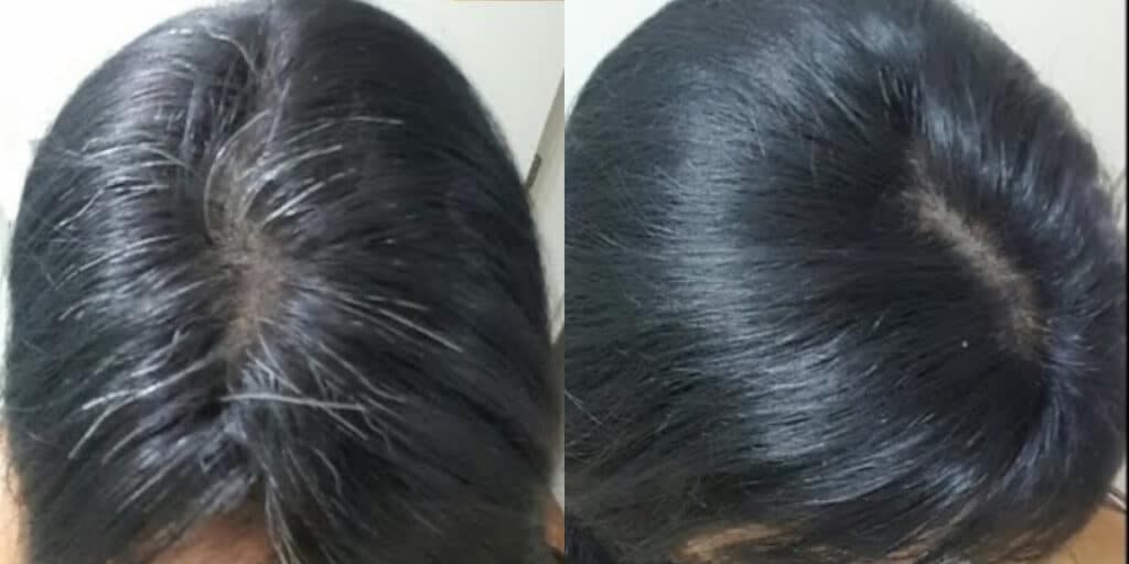 Tinta nunca mais: Misturinha caseira com 6 ingredientes dá fim aos cabelos brancos sem química em 5 minutos