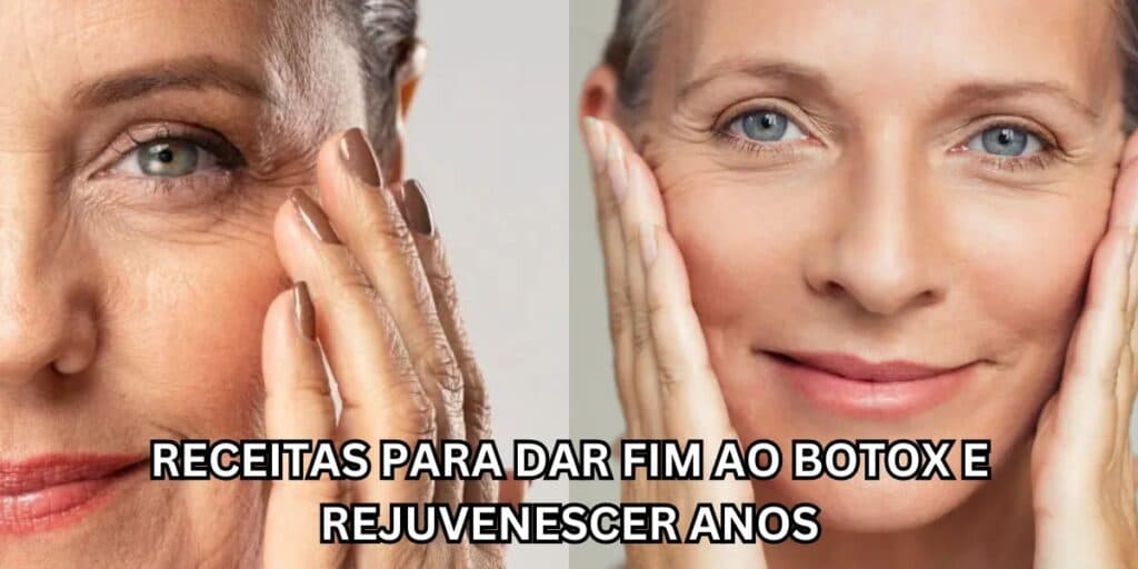 Adeus rugas, manchas no rosto e +: 5 receitas milagrosas e infalíveis para dar fim ao botox e rejuvenescer anos