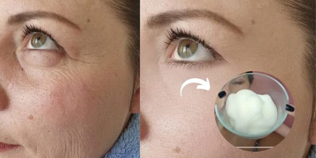 Sem rugas e 20 anos +jovem: Misturinha caseira com apenas 2 ingredientes te livra de plásticas AGORA