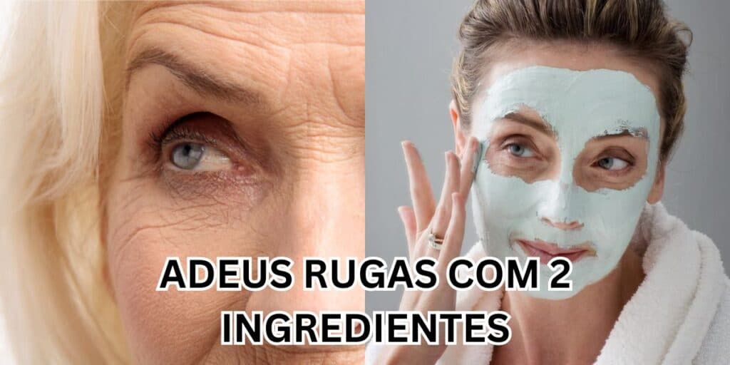 Adeus rugas: Receita caseira, melhor que botox, só com 2 ingredientes para ficar com carinha de 20