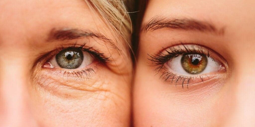Fim das rugas, manchas e olheiras: Dicas definitivas para uma pele de porcelana sem botox