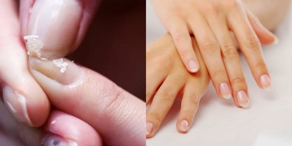 Adeus unhas quebradas e fracas: 5 dicas simples para deixar a unha enorme e fazer inveja em qualquer uma
