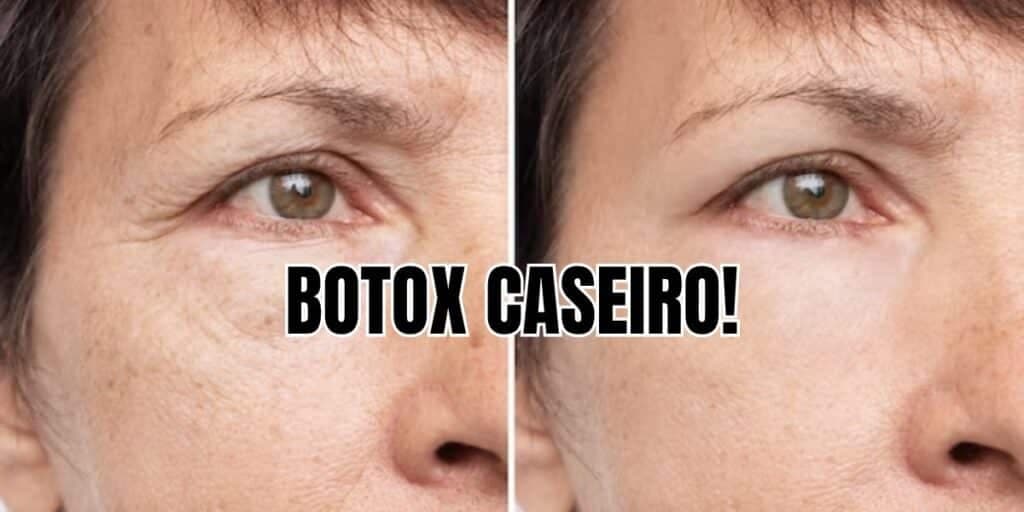Fim IMEDIATO das rugas: Receitinha de botox caseiro só com 4 ingredientes faz milagre no rosto das mulheres