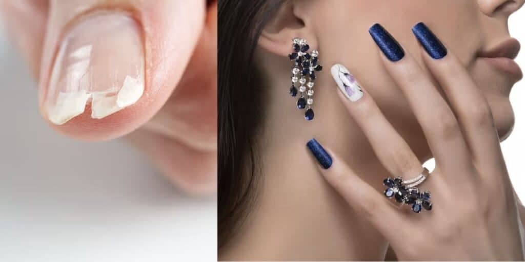 Manicures não contam: 3 receitinhas caseiras para as unhas durarem quase eternamente e não quebrarem mais