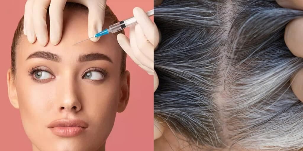 Pele de porcelana sem BOTOX e fim dos grisalhos: 2 receitinhas caseiras simples e pra rejuvenescer 20 anos