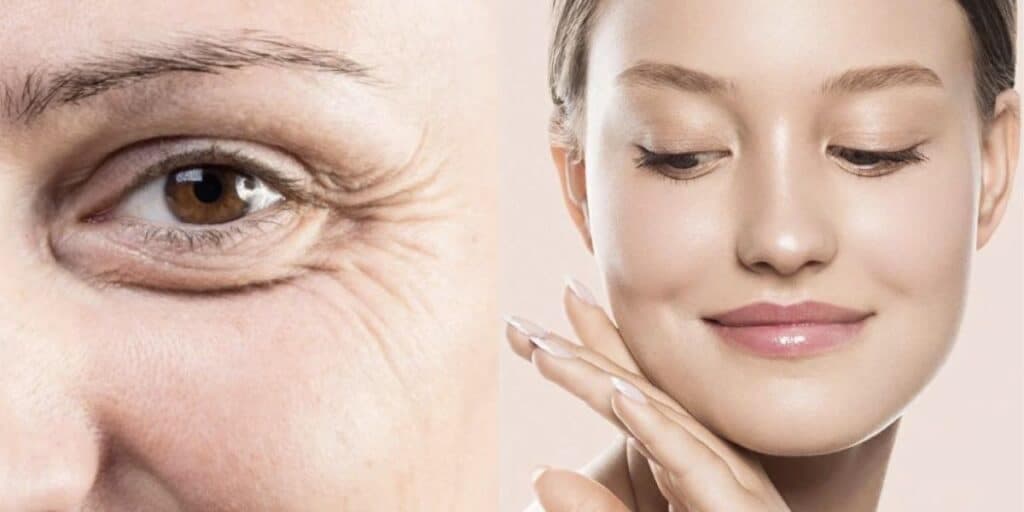 Botox de graça: Misturinha com ingredientes populares elimina rugas profundas e traz pele de seda