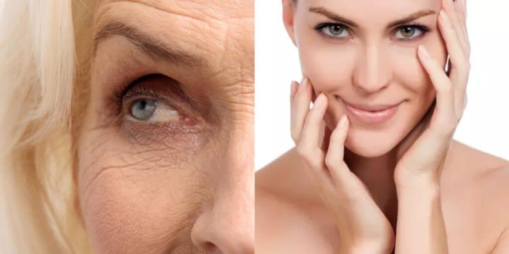 Melhor que plástica e 30 anos mais jovem: Receita de botox caseiro com 2 ingredientes dá fim às rugas