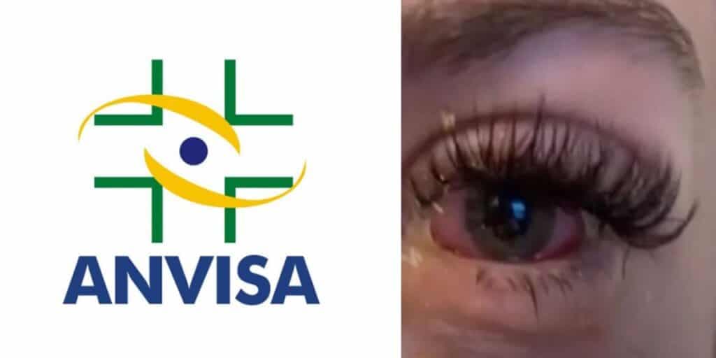 Cegueira: A proibição urgente da ANVISA contra 3 produtos amados pelas mulheres e retirada das prateleiras