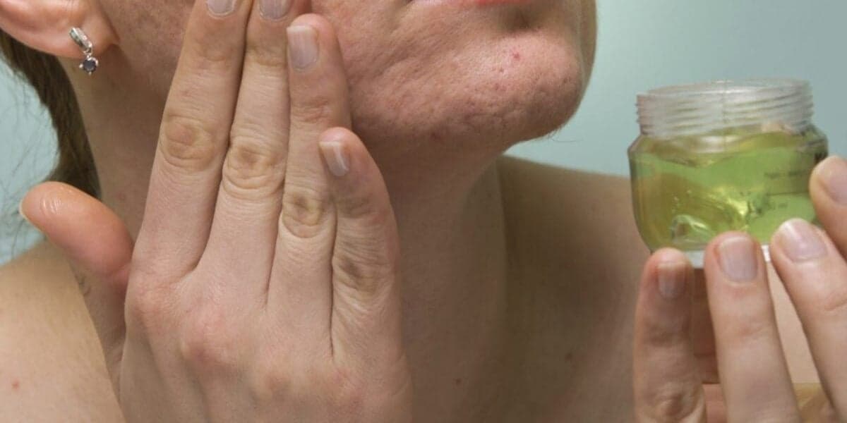 Máscara de colágeno para deixar a pele linda (Foto: Reprodução/ Internet)