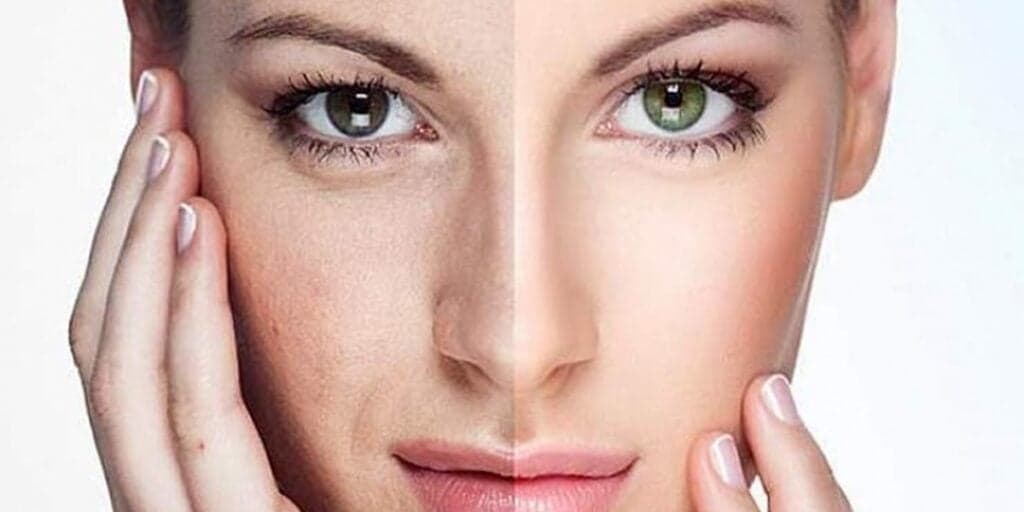 60+ com pele de porcelana: Mistura caseira com apenas 4 ingredientes é mais potente que Botox e dá fim das rugas