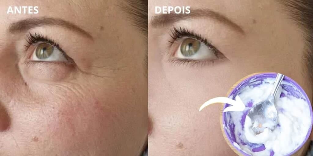 Melhor que botox e rejuvenesce 20 anos: Receitinha caseira com 2 ingredientes dá fim às rugas e manchas